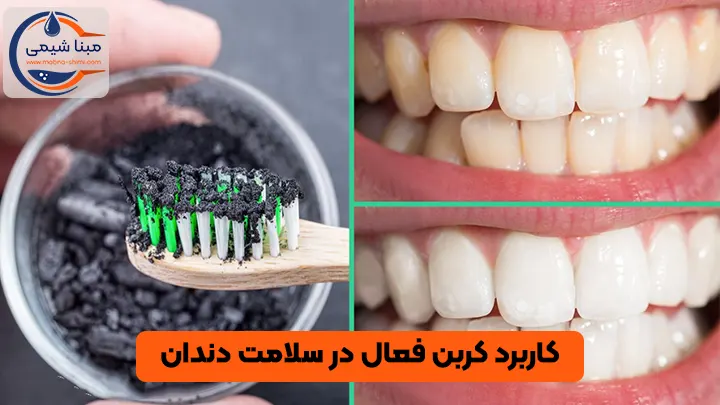 کاربرد کربن فعال در سلامت دندان
